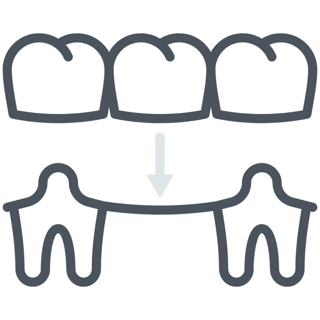 Protesi Fissa e Dentiera a Macherio